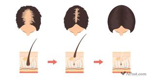 These 5 Good Habits Will Make Your Hair Healthier, Radiant, And Stronger