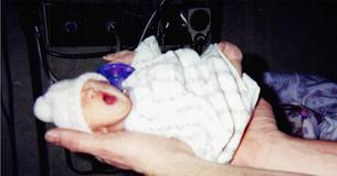 Artsen vertelden haar moeder dat ze slechts een paar dagen in leven zou blijven na de geboorte - 12 jaar later is ze een wandelend wonder