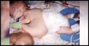 Des jumeaux conjoints sont connus dans le monde entier en 2002. 11 ans plus tard, ils sont de retour à la télé et vivent séparés