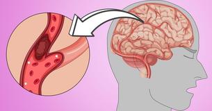 Are You Suffering From Headaches, Low Energy, And Insomnia? This Could Be The Solution