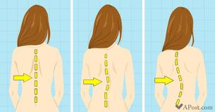 These 8 Daily Activities Could Damage Your Spine