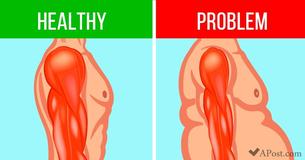 8 Early Symptoms of Muscle Degeneration You Definitely Should Not Ignore