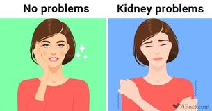 10 Non-Obvious Signs That Your Kidneys Are Not Working Like They Are Meant To