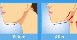 6 Foolproof Methods To Make Your Neck Look Younger
