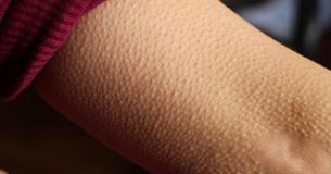 Si vous avez la chair de poule de l'écoute de la musique, alors vous pouvez avoir un cerveau très spécial