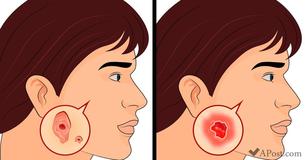 8 Medical Tests You Should Do To Prevent Illnesses Early On