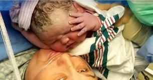 Les infirmières et le docteur étaient fébriles pendant la césarienne tandis que cette maman donnait naissance au plus grand et au plus mignon des bébés que j'aie jamais vu