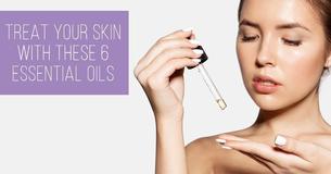 Treat Your Skin With These 6 Essential Oils