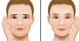 10 façons de se débarrasser de la peau flasque de votre visage et de votre cou 