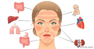 The Redness On Your Face Is Trying To Tell You About These 6 Internal Problems