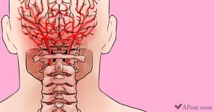 7 Methods To Effectively Get Rid Of Neck Pain