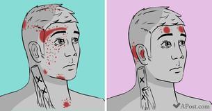 Top 7 Diet Mistakes That Could Be Triggering Your Severe Migraines