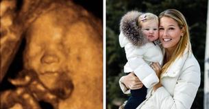 Âgée de 19 mois, elle se noie dans une piscine, 5 jours plus tard, sa mère enceinte aperçoit son visage dans l'ultrason de son fils