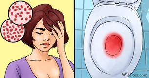 10 symptômes troublants qui indiquent que votre corps souffre d'une carence en fer