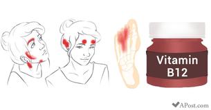 5 Ways You Can Tell If You Have Nutrient Deficiencies That Are Written All Over Your Face