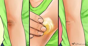 How To Remove Dark Knees And Elbows In 10 Natural Ways