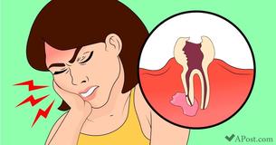 Stop Wisdom Tooth Pain With These 11 Super Effective Techniques