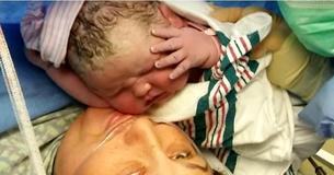 Le infermiere e il dottore hanno gridato per la sorpresa durante il cesareo con cui è nato il bambino più grande e carino che avessero mai visto