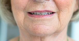 10 Natural Ways To A Young And Healthy Looking Face