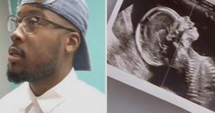 Vater von Zwillingen fällt in Ohnmacht, als er das Ultraschallbild seiner schwangeren Frau beim Arzt sieht