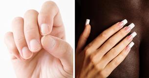 These 10 Natural Methods Could Help You Fix Your Brittle Nails