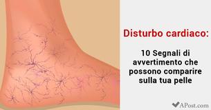 Disturbi cardiaci: 10 sintomi che compaiono sulla pelle