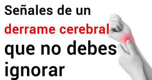 Señales de un derrame cerebral que nunca debes ignorar