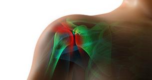 7 Effective And Natural Remedies For Pain In Your Rotator Cuff