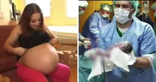 Les médecins de la salle d'accouchement sont choqués d'être témoins d'une naissance rare et historique d'une mère âgée de 23 ans