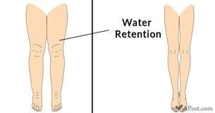 5 Reasons Your Body Is Retaining Water - And How You Can Avoid It