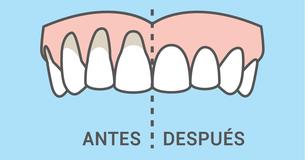10 formas sencillas y naturales para sanar las encías retraídas