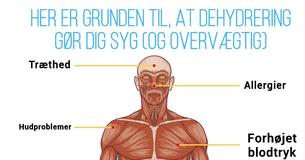 Dehydrering gør dig ikke blot syg – det gør dig også overvægtig