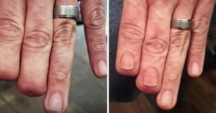 Un artiste de tatouage aide des survivants du cancer et des amputés en leur offrant des tatouages hyper-réalistes