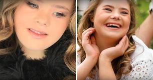 Cette magnifique adolescente atteint de trisomie 21 est mannequin et à la plus de 50 000 abonnés sur Instagram et a déjà signé avec 5 agences 