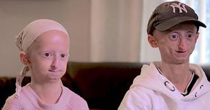 Le docteur dit à la mère qu'elle ne peut pas concevoir un autre bébé qui vieillit rapidement - alors la soeur est née la même maladie
