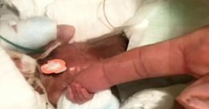 Le plus petit bébé garçon survivant de l'histoire quitte l'hôpital en bonne santé