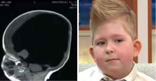 Un garçon né sans cerveau a toutes les chances de vivre après avoir "grandit"