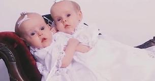 Les sœurs siamoises étaient célèbres en 2002. 11 ans plus tard, elles sont de retour à la télévision pour partager leurs vies séparées.