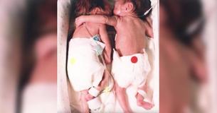 L'infirmière met le bébé mourant à côté de son jumeau. Elle lui donne un câlin et cela conduit à un miracle