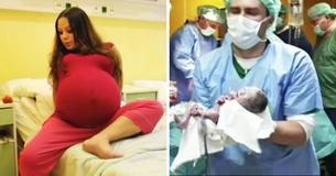 Les médecins dans la salle d'accouchement témoignent de l'accouchement extraordinaire d'une mère de 23 ans