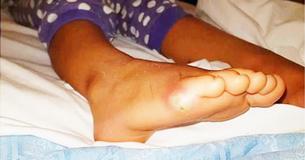 Un enfant de 4 ans a développé une septicémie après avoir magasiné pour des chaussures sans chaussettes - Voilà ce que les médecins en pensent