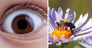 Woman Suffers Severe Eye Pain And Swelling, Discovers She Has 4 Live Bees Inside Her Eyelid