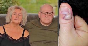 Grandfather Left Fighting For His Life After Developing Sepsis Due To Biting His Nails
