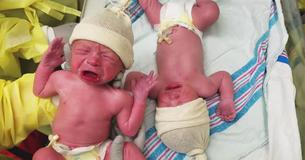 Personne, pas même les médecins, ne pouvait en croire leurs yeux lors des premiers moments de ces bébés jumeaux