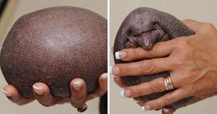 Baby Hedgehog With No Prickles Has To Be Massaged Daily To Stay Warm