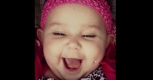 Une photo d'un bébé avec la joue "percée" enflamme l'indignation et la maman dit que cela prouve l'importance de la circoncision