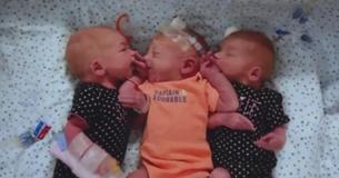 Une femme croyait qu'elle avait des calculs rénaux, mais elle a fini par donner naissance à des triplés