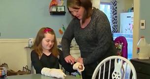 Kids Have Been Left With Burns On Their Hands After Trying Out This New Trend