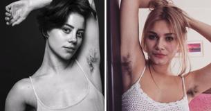 Les femmes reviennent sur la stigmatisation de la pilosité féminine en publiant des photos de femmes avec des poils sous les bras