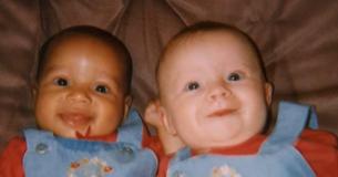 Les cas de jumeaux nés avec une couleur de peau différente sont de un sur un million, et c'est le cas de deux jumelles en Angleterre, maintenant âgées de 20 ans.
